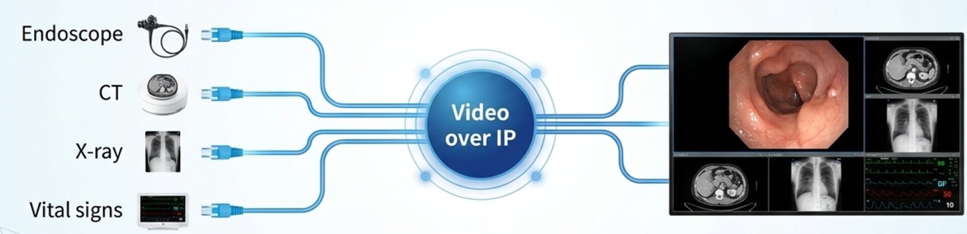 Video over IP — Nexxisによる映像統合のシンプル配線図